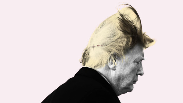 Cirujanos plásticos tratan de resolver el misterio del cabello de Trump