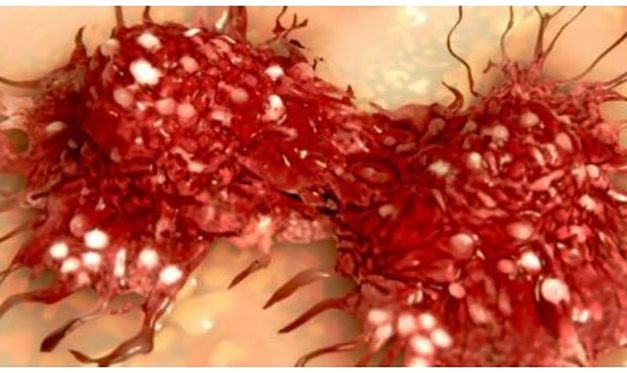 Los científicos han demostrado que la negatividad literalmente hace que el cáncer crezca dentro del cuerpo