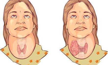 Hipotiroidismo: ¿qué es y lo padece?